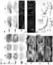 Fig. 08 - Novel Compounds for Imaging Tau Proteins That Accumulate in the Brain