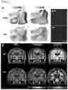 Fig. 10 - Novel Compounds for Imaging Tau Proteins That Accumulate in the Brain