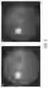 Fig. 06 - Compositions and methods for treating leber's hereditary optic neuropathy