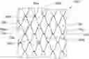 Fig. 01 - Wire netting system