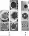 Fig. 07 - Scalable floating micro-aeration unit, devices and methods