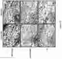 Fig. 30 - Compositions and methods for treating cancer