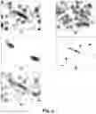 Fig. 06 - Method, system and computer program for computer-assisted evaluation of biomarkers in a tissue sample