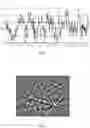 Fig. 08 - System for electron diffraction analysis