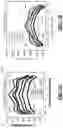 Fig. 02 - Variable depth edge ring for etch uniformity control