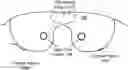 Fig. 01 - Adjustable mask