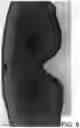 Fig. 12 - Adjustable mask