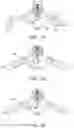 Fig. 11 - Brackets for minimal penetration modular roof-top mounting racks and solar photovoltaic systems and method for using the brackets