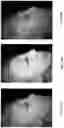 Fig. 15 - Systems and methods for spectral imaging with compensation functions