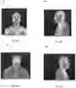Fig. 05 - Three Dimensional Rapid Imaging System and Method