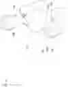 Fig. 02 - Prenatal sound device