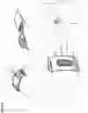 Fig. 23 - Prenatal sound device