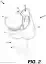 Fig. 03 - MICROPHONE MOUNTING SYSTEM FOR DIGITAL DEVICES AND METHOD OF USE