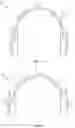 Fig. 02 - Headphones with magnetic sensor