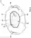 Fig. 03 - Pet Bed Covering Assembly