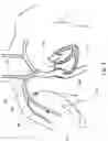 Fig. 02 - Devices and methods for vascular navigation, assessment and/or diagnosis