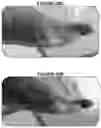 Fig. 29 - Methods of manufacture of immunocompatible amniotic membrane products