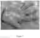 Fig. 02 - Topical compositions, process of large-scale manufacture, and method of use