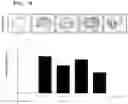 Fig. 06 - Antithrombotic composition containing and 
