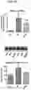 Fig. 07 - MITOCHONDRIAL-TARGETED ANTIOXIDANTS PROTECT AGAINST MECHANICAL VENTILATION-INDUCED DIAPHRAGM DYSFUNCTION AND SKELETAL MUSCLE ATROPHY