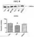 Fig. 11 - MITOCHONDRIAL-TARGETED ANTIOXIDANTS PROTECT AGAINST MECHANICAL VENTILATION-INDUCED DIAPHRAGM DYSFUNCTION AND SKELETAL MUSCLE ATROPHY