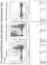 Fig. 15 - Combination therapy for C3 inhibition