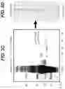 Fig. 05 - Method of Treating Myasthenia Gravis