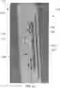 Fig. 11 - Ready armor protection for instant deployment