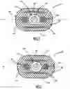 Fig. 02 - Fiber optic cable for distributed sensing with rodent resistant components from hardened materials
