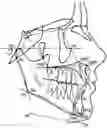 Fig. 01 - Method of analyzing dental image for correction diagnosis and apparatus using the same