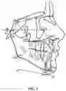 Fig. 02 - Method of analyzing dental image for correction diagnosis and apparatus using the same