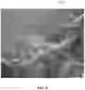 Fig. 09 - Method of analyzing dental image for correction diagnosis and apparatus using the same