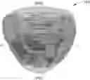 Fig. 01 - Apparatus and method for determining the spatial probability of cancer within the prostate