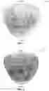 Fig. 06 - Apparatus and method for determining the spatial probability of cancer within the prostate