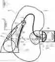 Fig. 01 - Hearing device comprising a sensor configuration detector