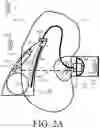 Fig. 04 - Hearing device comprising a sensor configuration detector