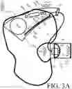 Fig. 06 - Hearing device comprising a sensor configuration detector