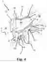 Fig. 05 - Hearing device with vent