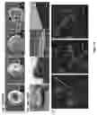 Fig. 11 - BIOCIDAL SURFACE