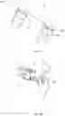 Fig. 08 - Breast support garment