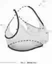 Fig. 02 - Breast support garment