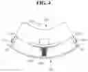 Fig. 05 - Eyelash extension system