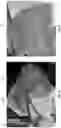Fig. 04 - SWIMMING HEAD CAP