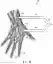 Fig. 17 - System for non-invasive measurement using cameras and time of flight detection