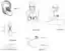 Fig. 44 - Methods and apparatuses for assessment and management of hemodynamic status