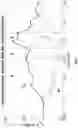 Fig. 09 - Methods of evaluating cerebrovascular reactivity using transcranial doppler