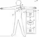 Fig. 01 - Systems and methods for detecting atrial tachyarrhythmia