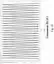 Fig. 16 - MODELLING AND EXTRACTING INFORMATION FROM A PHOTOPLETHYSMOGRAPHY, PPG, SIGNAL