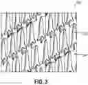Fig. 04 - METHOD OF MANUFACTURING HEAD FIXATION DEVICE COMPONENTS