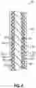 Fig. 07 - METHOD OF MANUFACTURING HEAD FIXATION DEVICE COMPONENTS